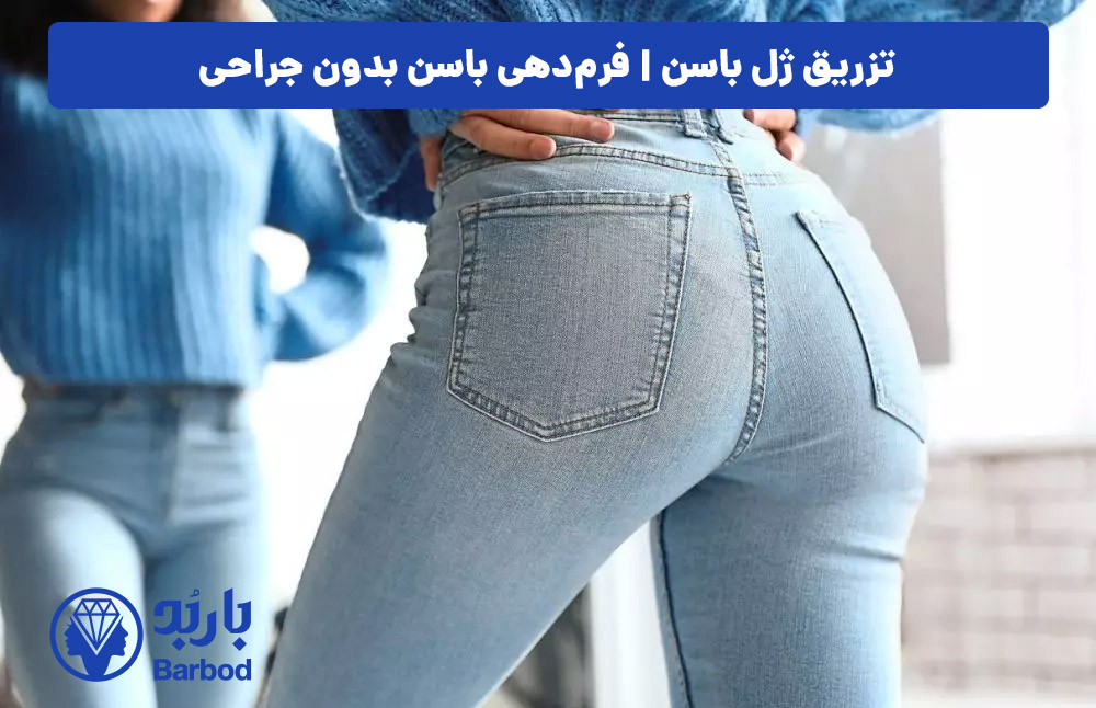 تزریق فیلر باسن