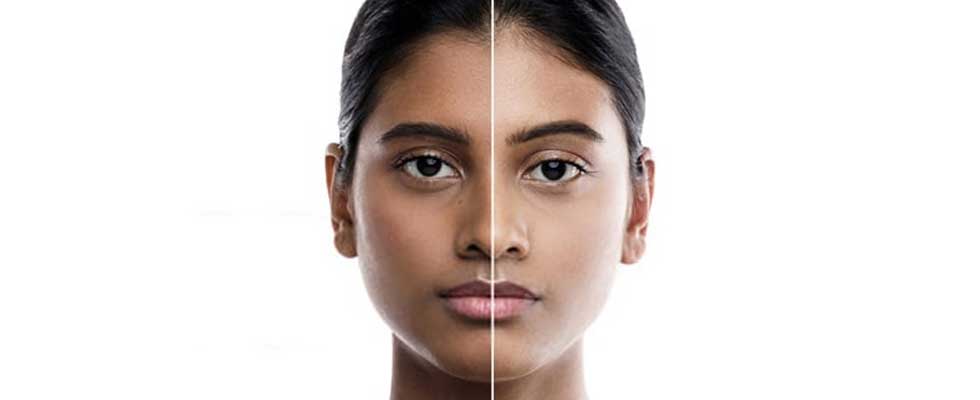 اصول سفید شدن پوست سبزه با محصولات طبیعی