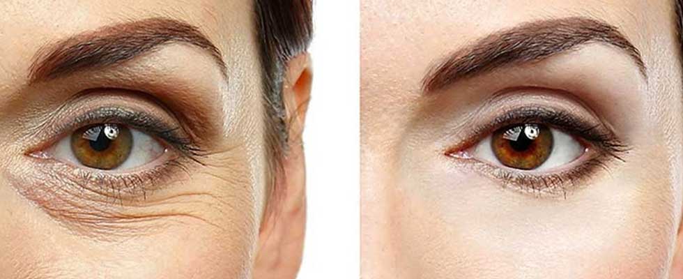 ترکیب روش های علمی و طبیعی