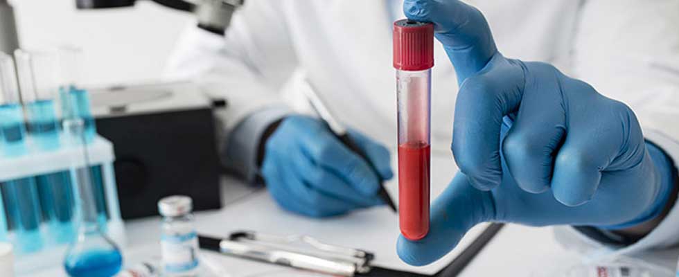 خدمات آزمایشگاهی لیما طب در منزل