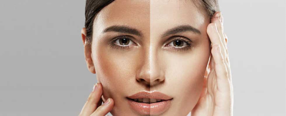 راهنمای خرید و انتخاب محصولات سیلکر برای سفید شدن پوست