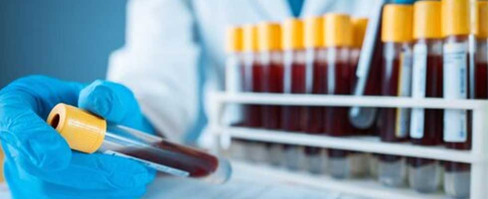 چگونه می‌ توانیم از خدمات لیماطب استفاده کنیم؟