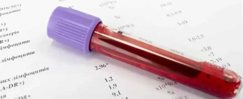 چگونه نتایج آزمایش را در جدول تحلیل کنیم؟