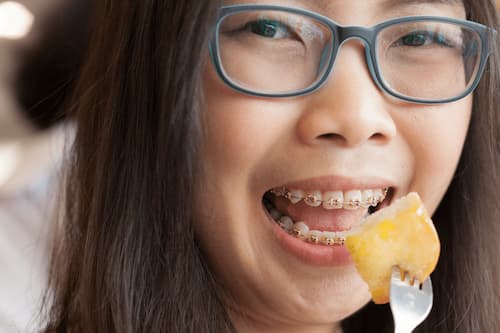 چند ساعت بعد از ارتودنسی غذا بخوریم