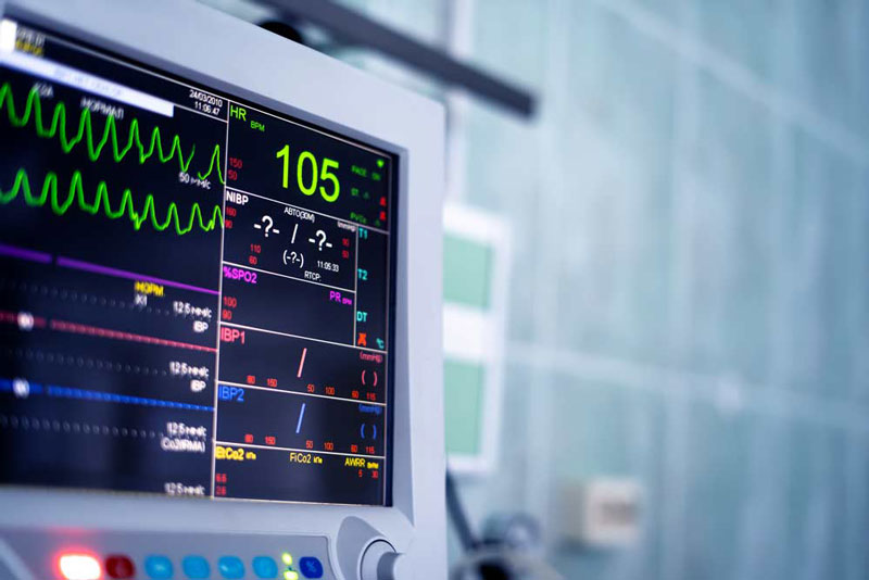 مقایسه جامع دستگاه نوار قلب (ECG) در بازار تجهیزات پزشکی ایران: راهنمای انتخاب بهترین مدل برای نیاز شما