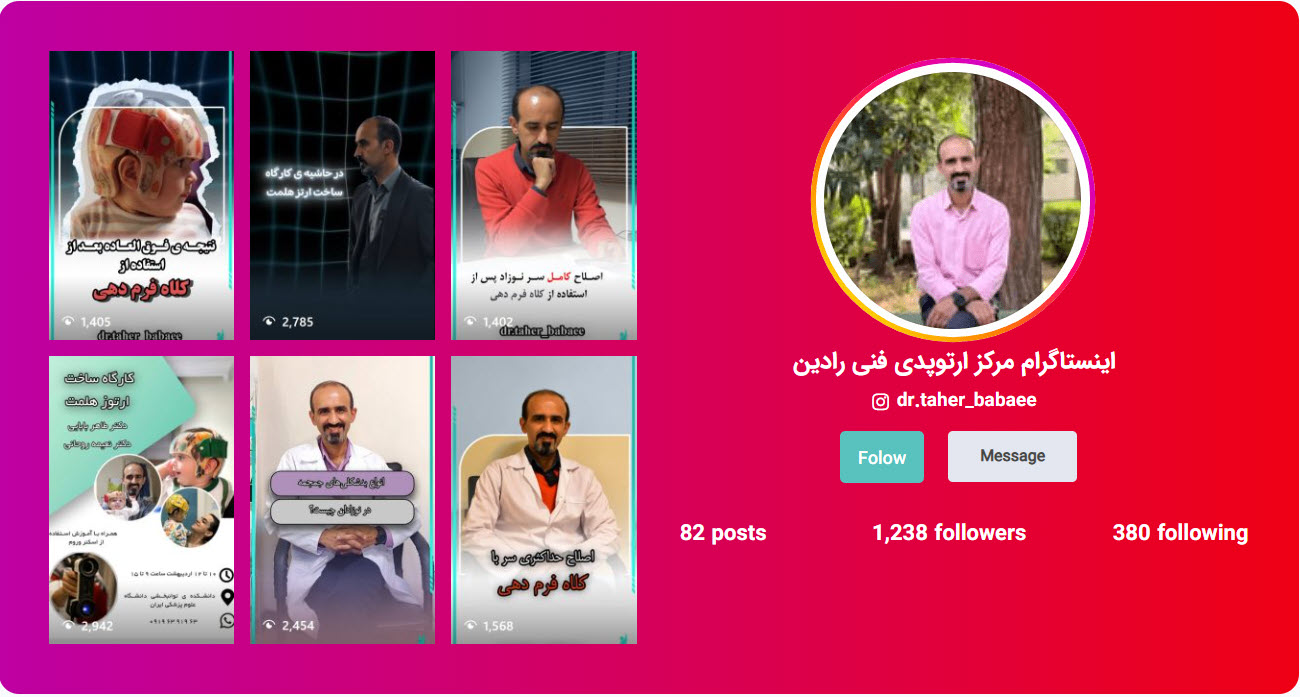 اینستاگرام دکتر طاهر بابایی برای درمان دفرمگی جمجعه نوزاد