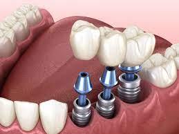 اهمیت تجهیزات و دستگاه_های مورد استفاده در کلینیک_های دندانپزشکی