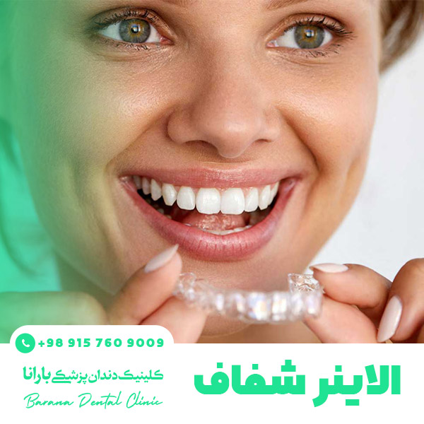 ارتودنسی متحرک نامرئی