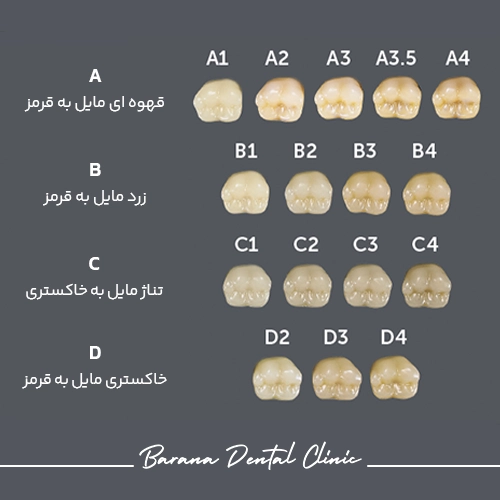 رنگ‌های مختلف کامپوزیت دندان