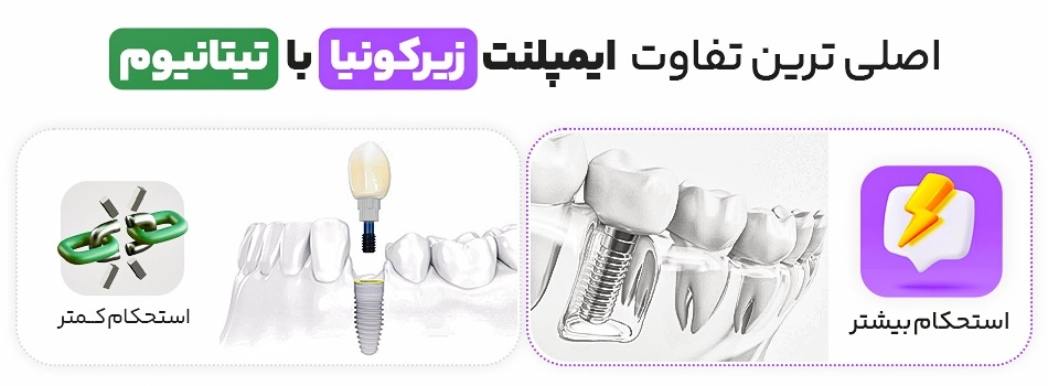 ایمپلنت زیرکونیا و تیتانیوم، محبوب‌ترین انواع هستند که باهم تفاوت‌هایی دارند.