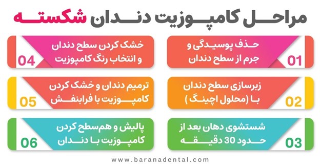 مراحل کامپوزیت دندان شکسته