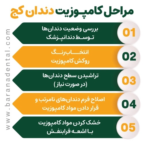 مراحل کامپوزیت دندان کج