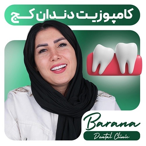 کامپوزیت دندان نامرتب